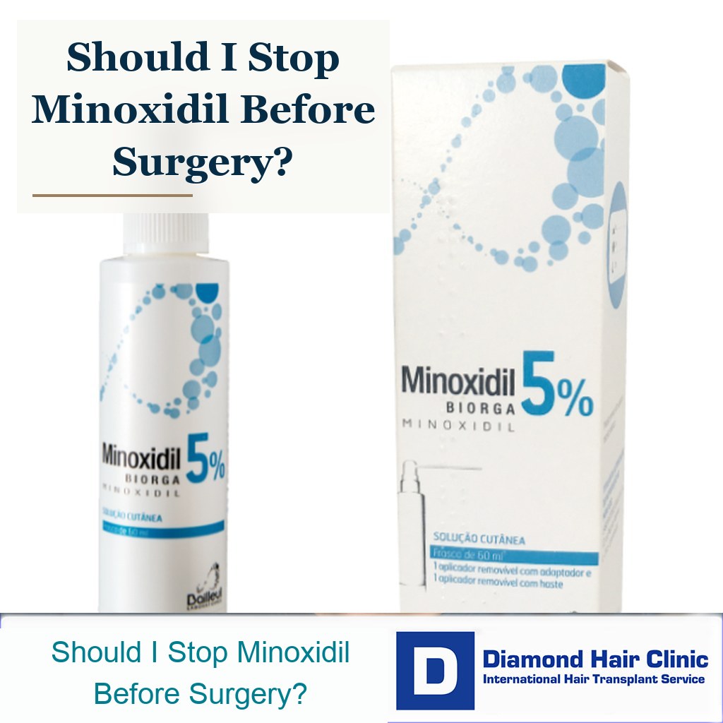 Should I Stop Minoxidil Before a Hair Transplant?
