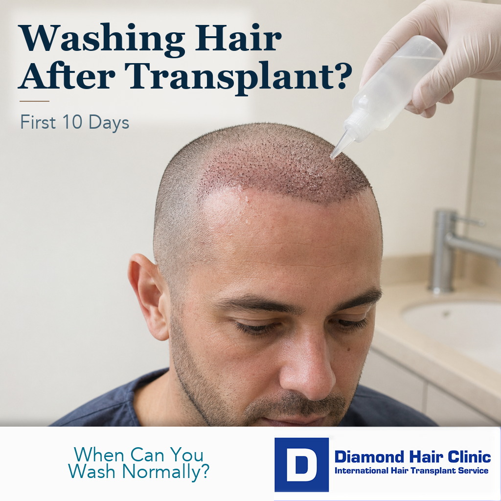 Adult male patient receiving gentle scalp rinsing during early washing after a hair transplant.