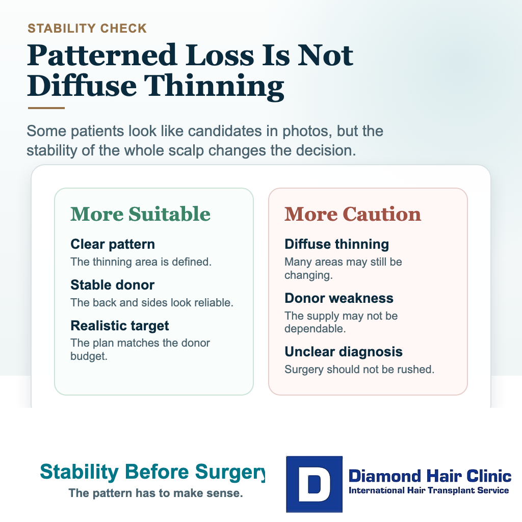Hair transplant candidate visual comparing patterned hair loss with diffuse thinning and donor weakness