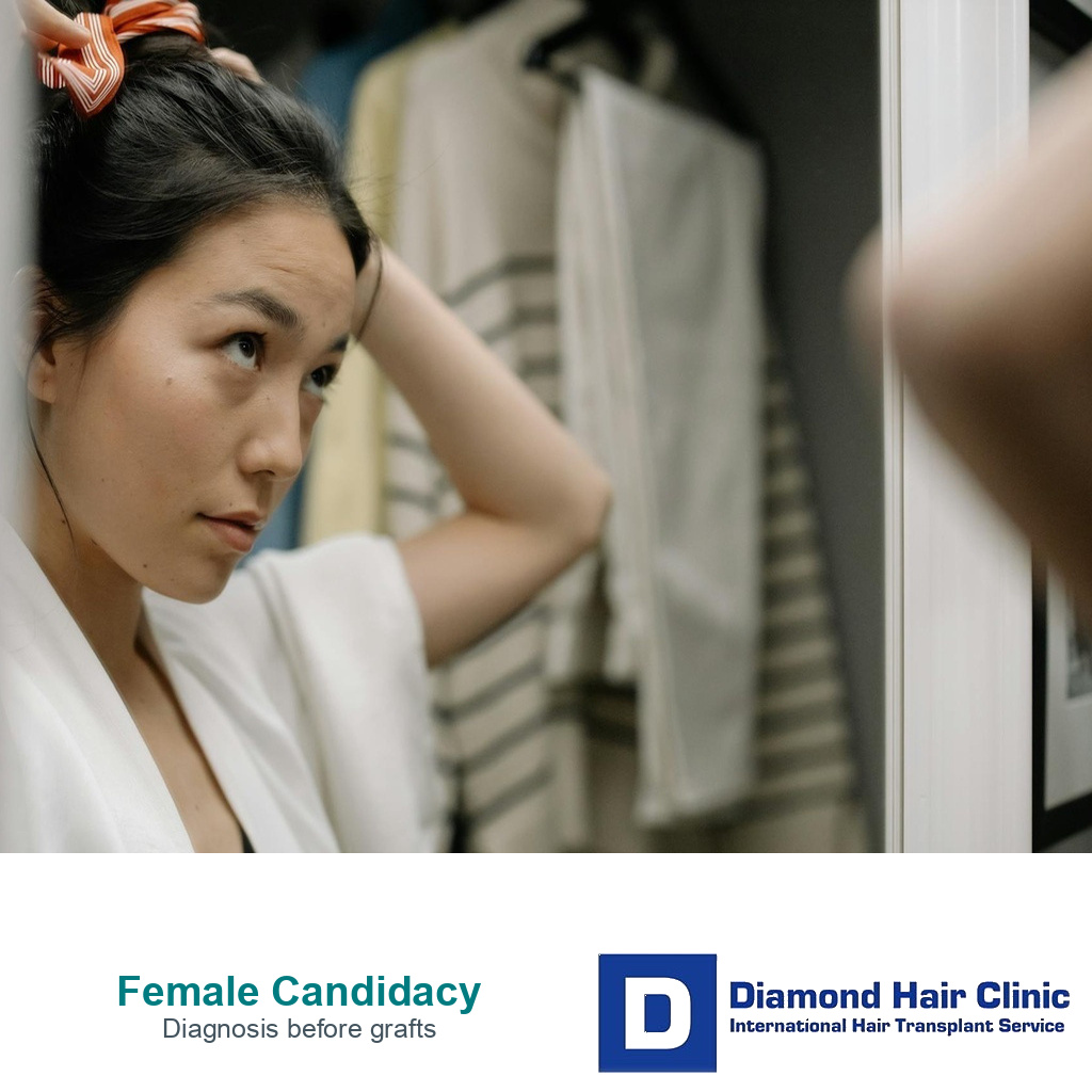 Woman checking her hairline in a mirror before a female hair transplant candidacy consultation.
