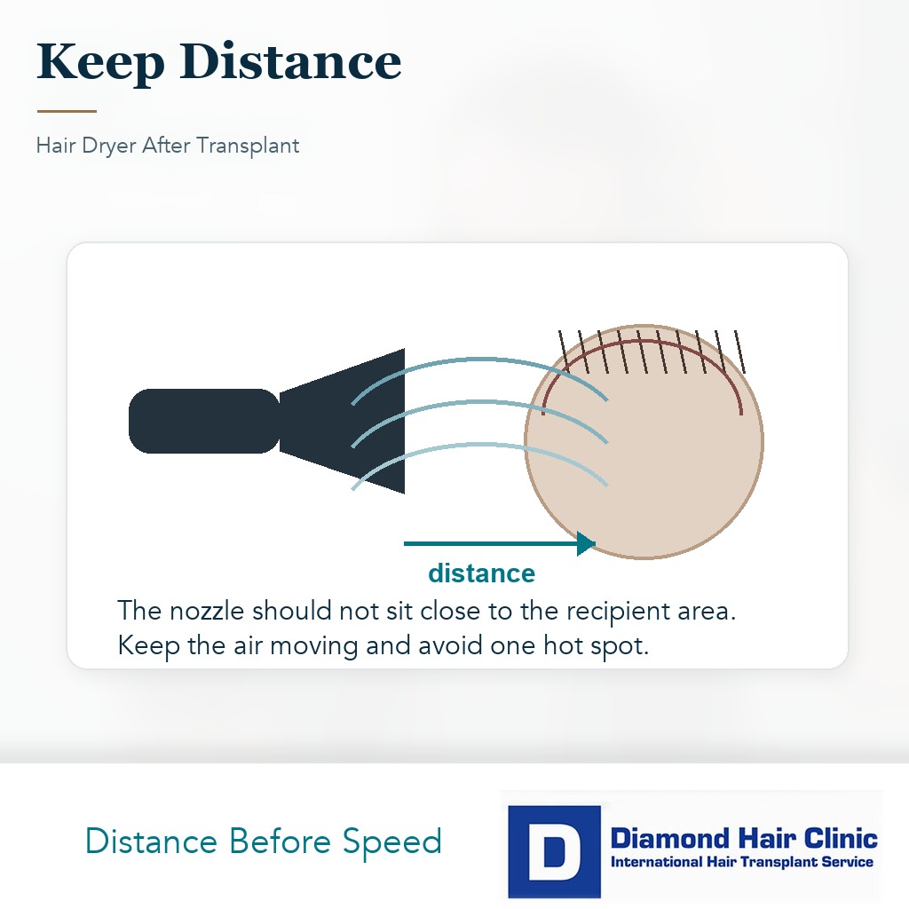 Hair dryer distance diagram showing the dryer kept away from the transplanted scalp