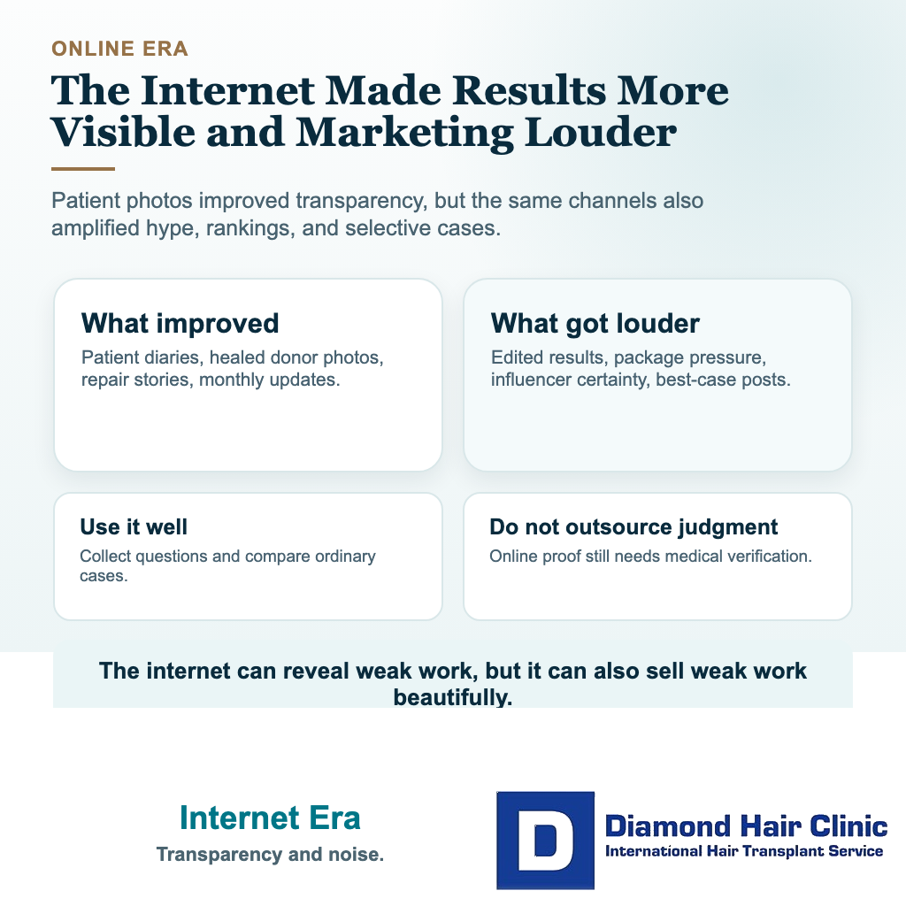 Visual explaining internet era in the history of hair transplantation