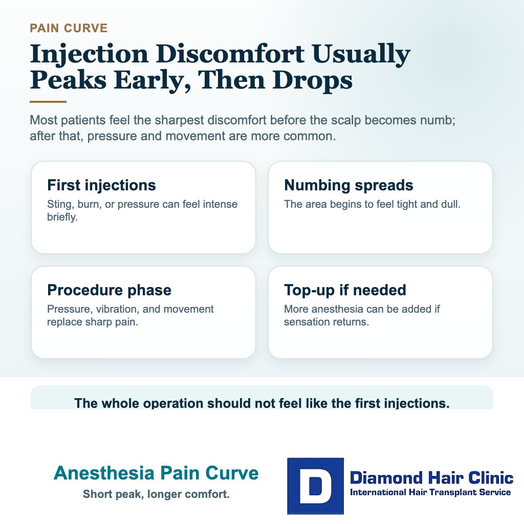 How Painful Are Anesthetic Injections During a Hair Transplant? visual explaining anesthesia pain curve