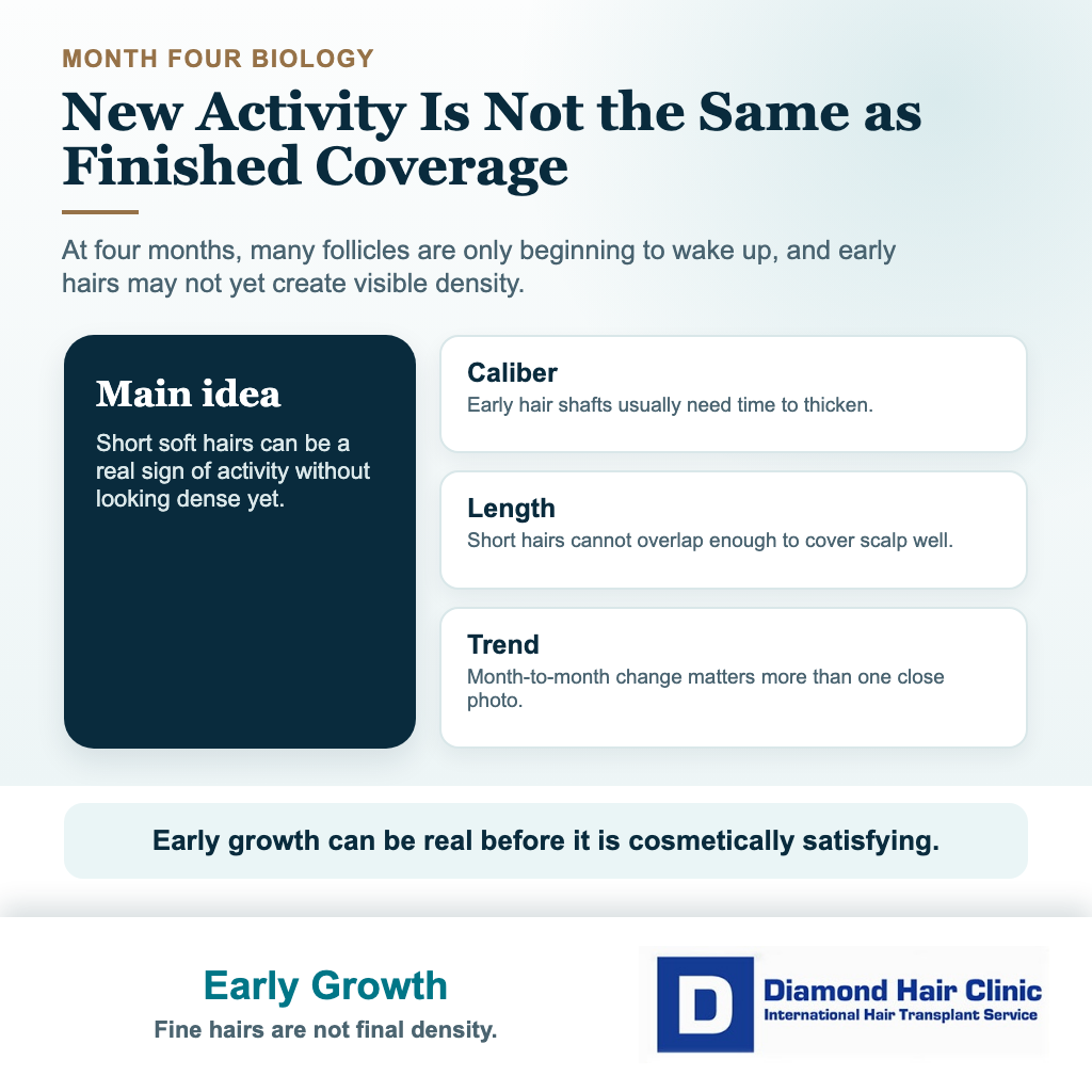 Card explaining why early hairs at 4 months are short fine and not yet full coverage after hair transplant