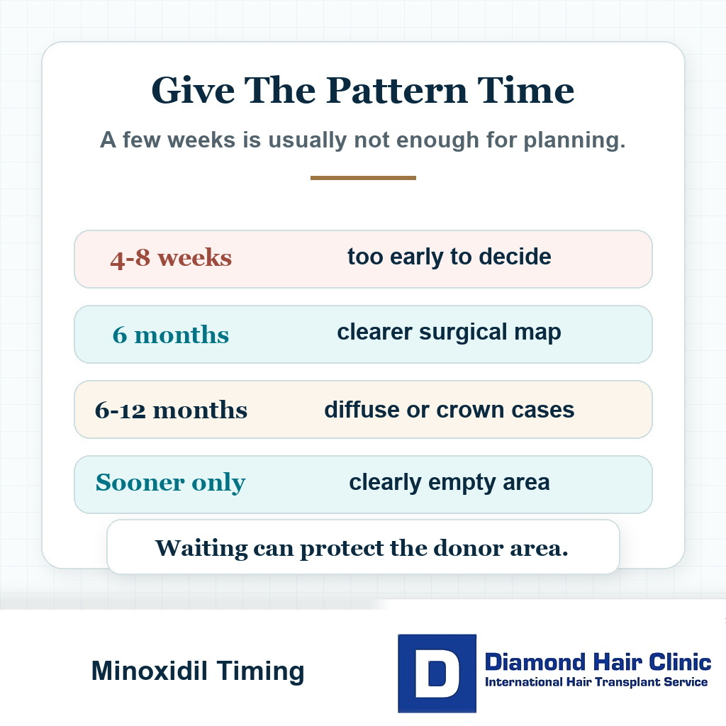 Timeline card showing safer planning windows after starting or changing minoxidil before hair transplant surgery