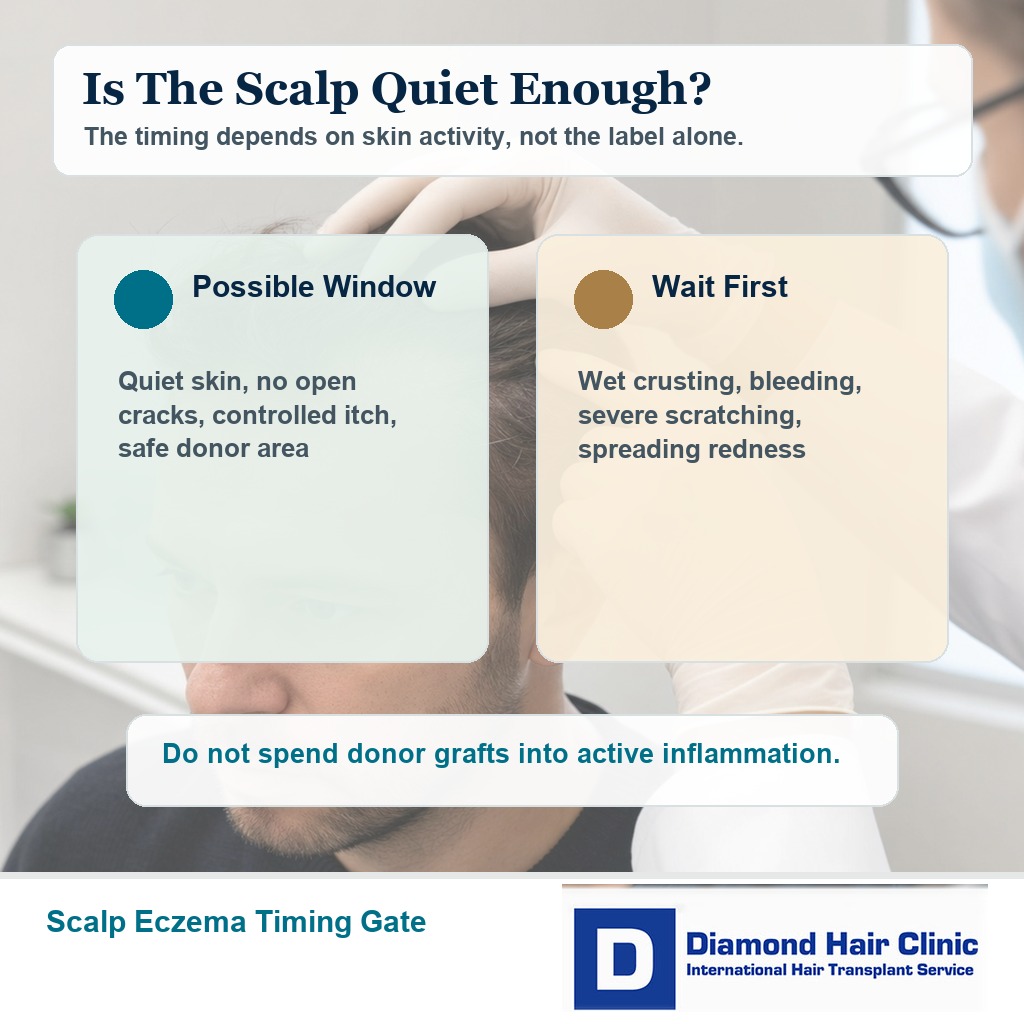 Premium medical editorial visual explaining when scalp eczema should be quiet before hair transplant surgery