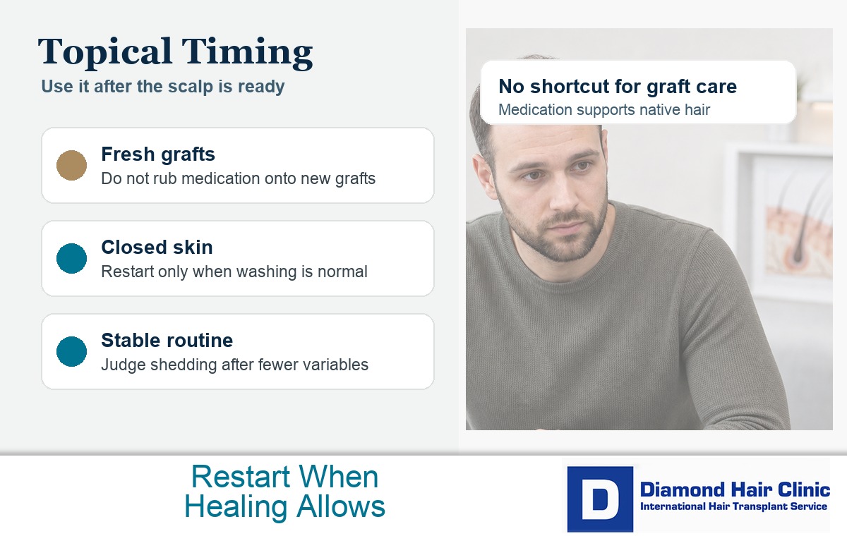 Visual explaining when topical finasteride may be restarted after the scalp is ready following a hair transplant