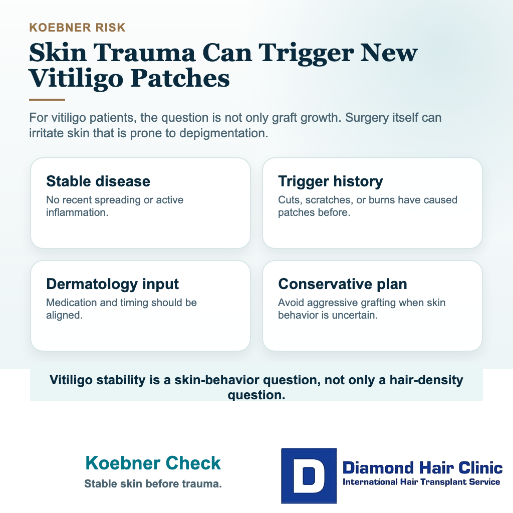 Can I Have a Hair Transplant With Vitiligo? visual explaining koebner check
