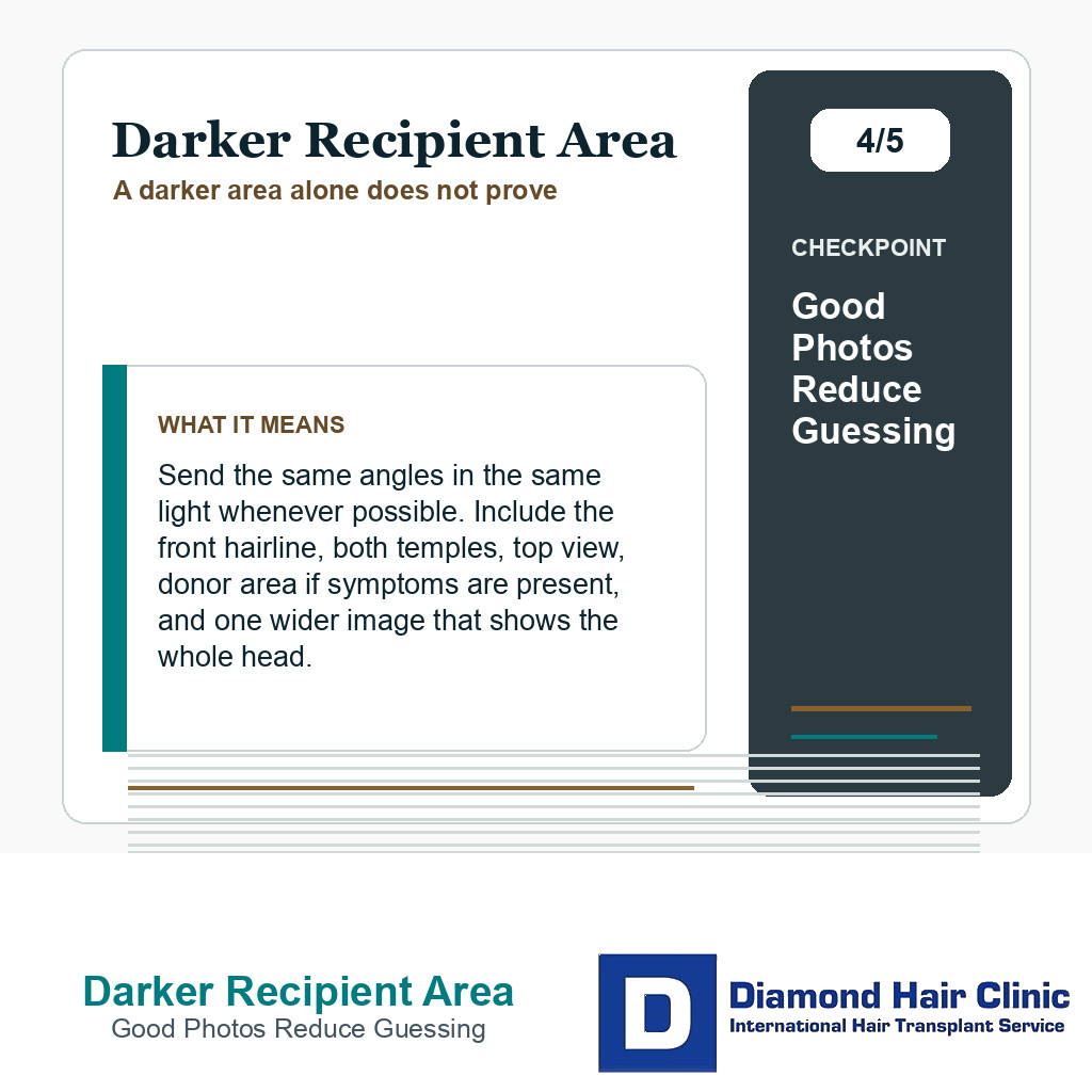 Darker Recipient Area carousel slide about good photos reduce guessing
