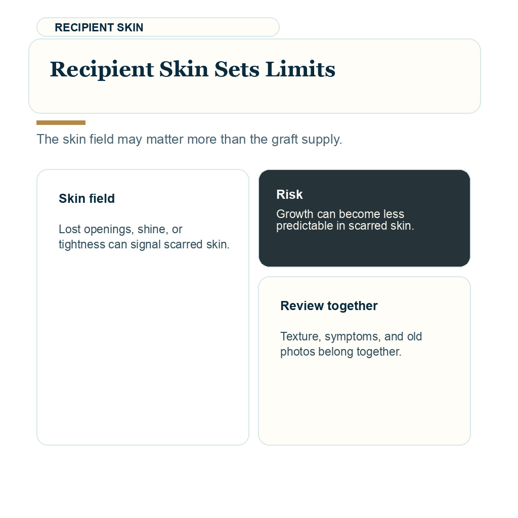 Slide 4 in a Diamond Hair Clinic carousel about recipient area limits in FFA hair transplant planning