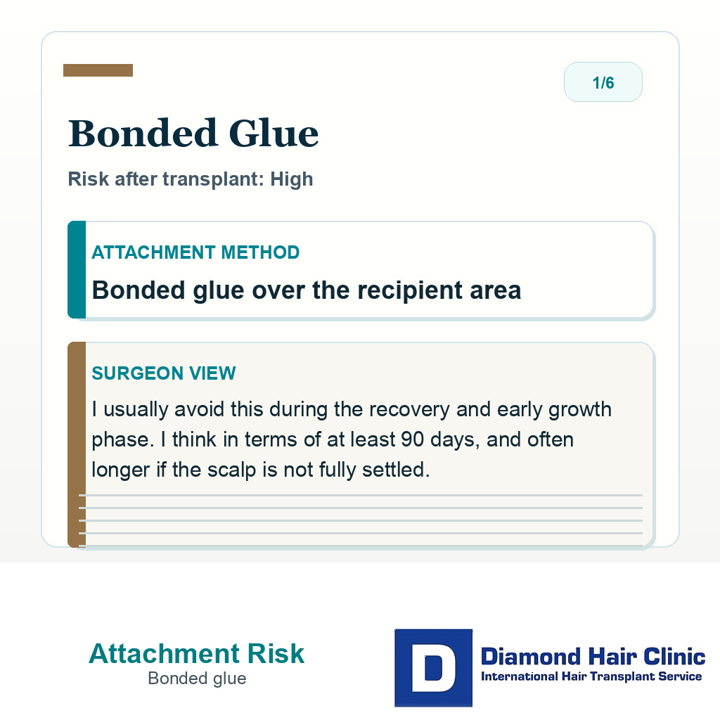 Hair system attachment risk slide explaining that bonded glue over the recipient area is high risk after transplant