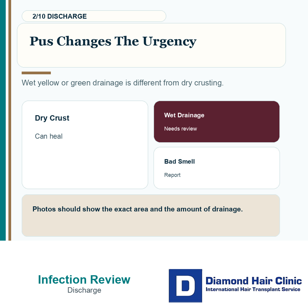 Infection warning carousel slide 2 explaining pus and drainage urgency