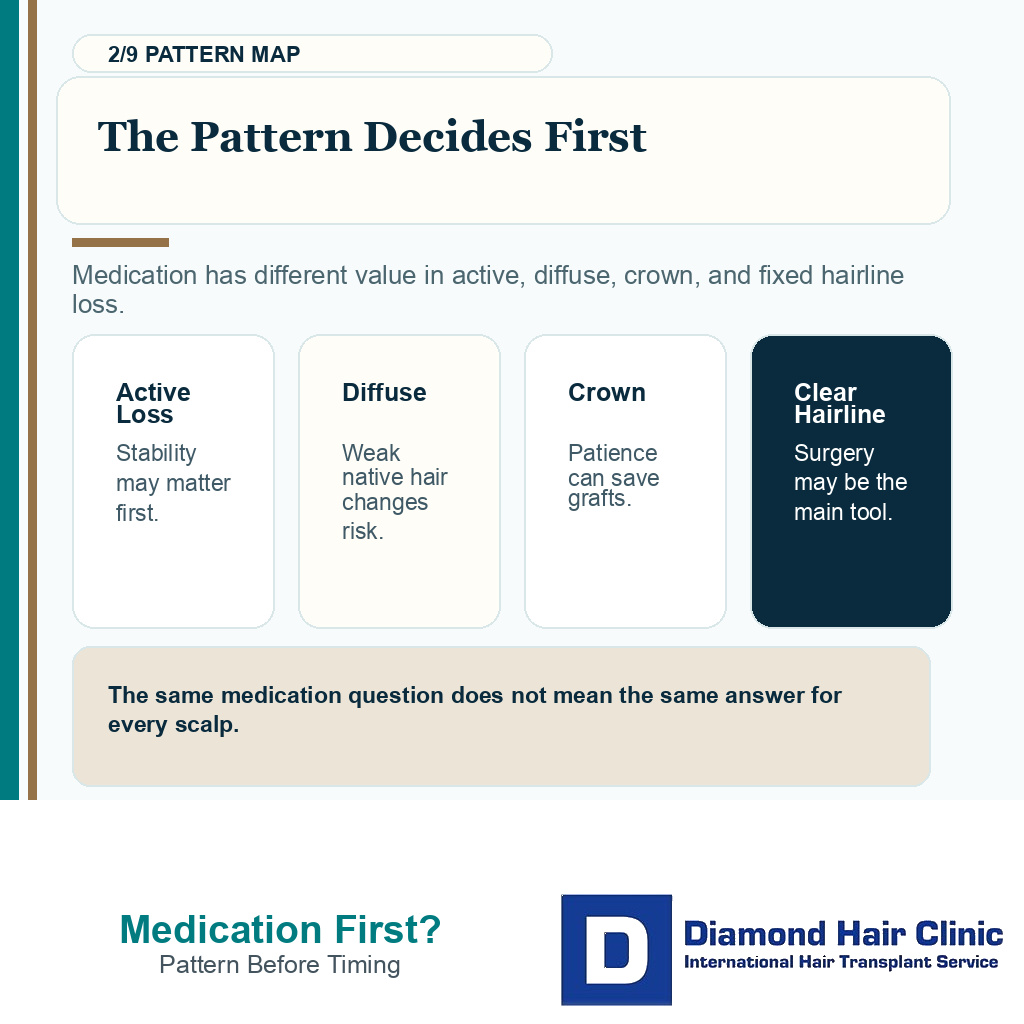 Medication before hair transplant planning carousel slide 2 explaining pattern decides first