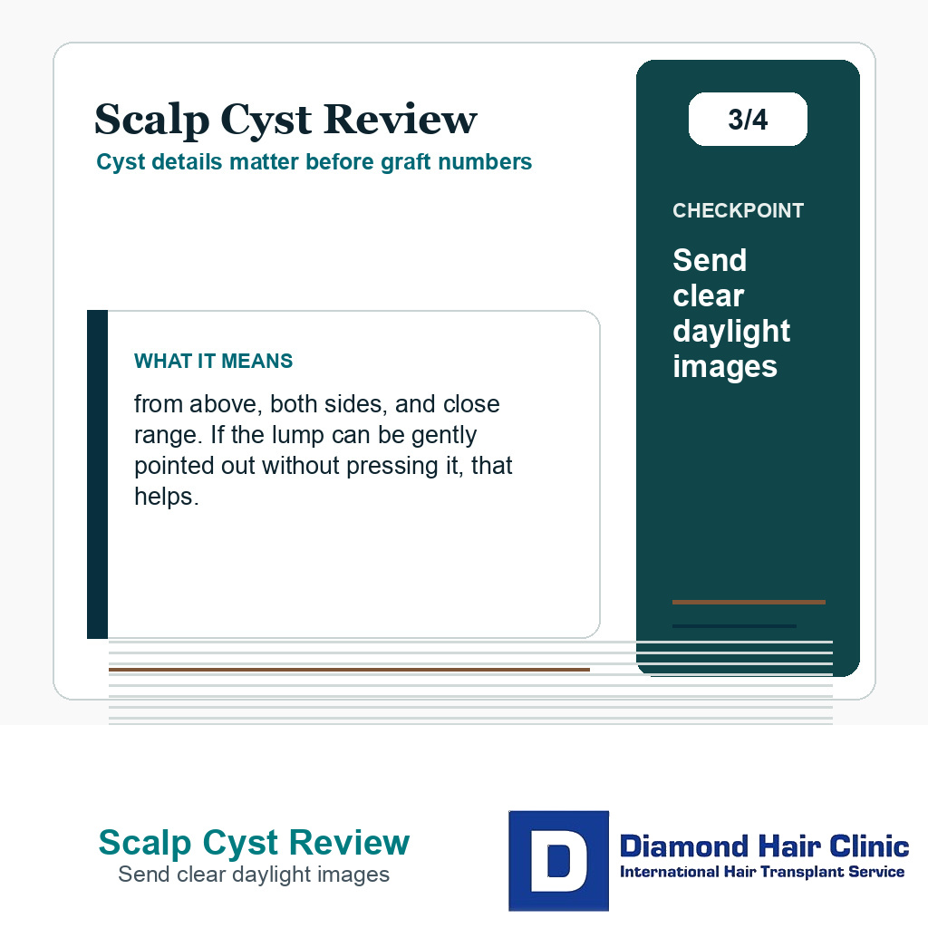 Scalp Cyst Review carousel slide about send clear daylight images