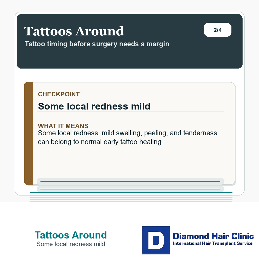 Tattoos Around carousel slide about some local redness mild