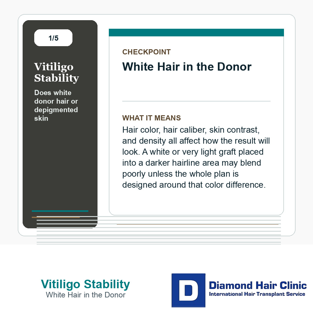Vitiligo Stability carousel slide about white hair in the donor