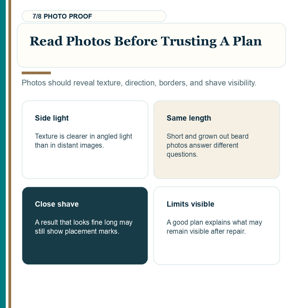Beard transplant repair limits, read photos before trusting a plan.