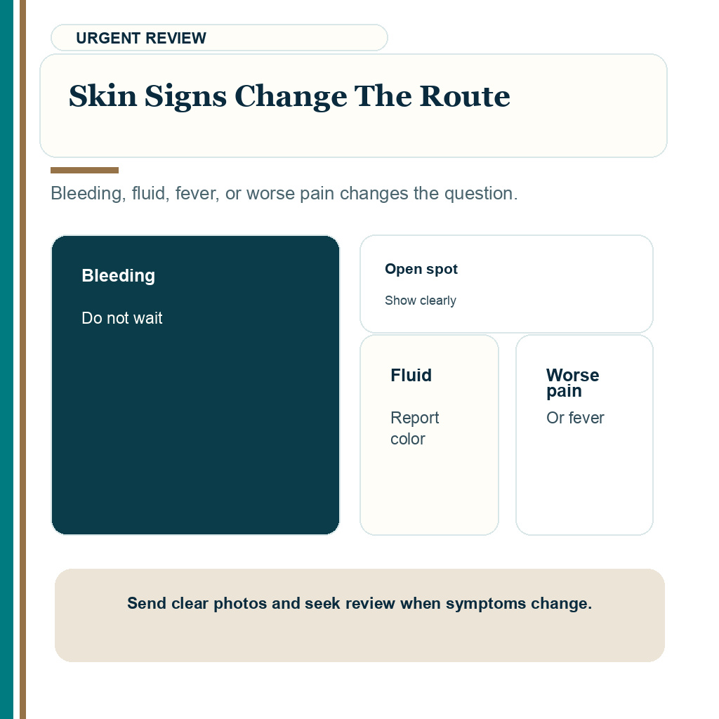 Early hair transplant review photos carousel slide 7 about skin signs change the route.