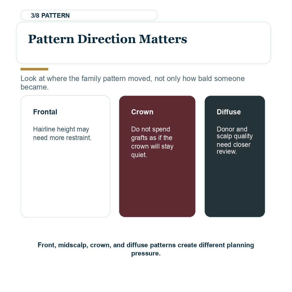 Pattern direction card comparing temple, mid scalp, and crown risk in family hair loss