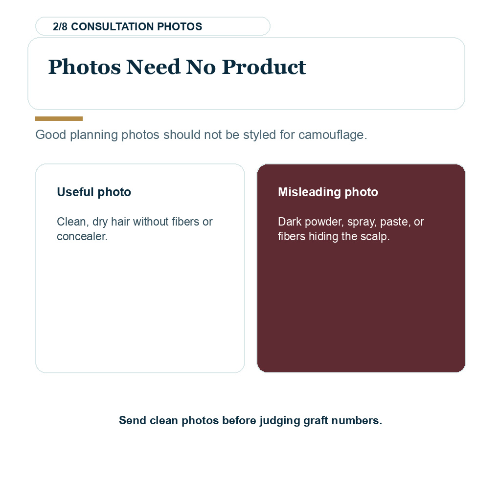 No product in consultation photos before hair transplant planning
