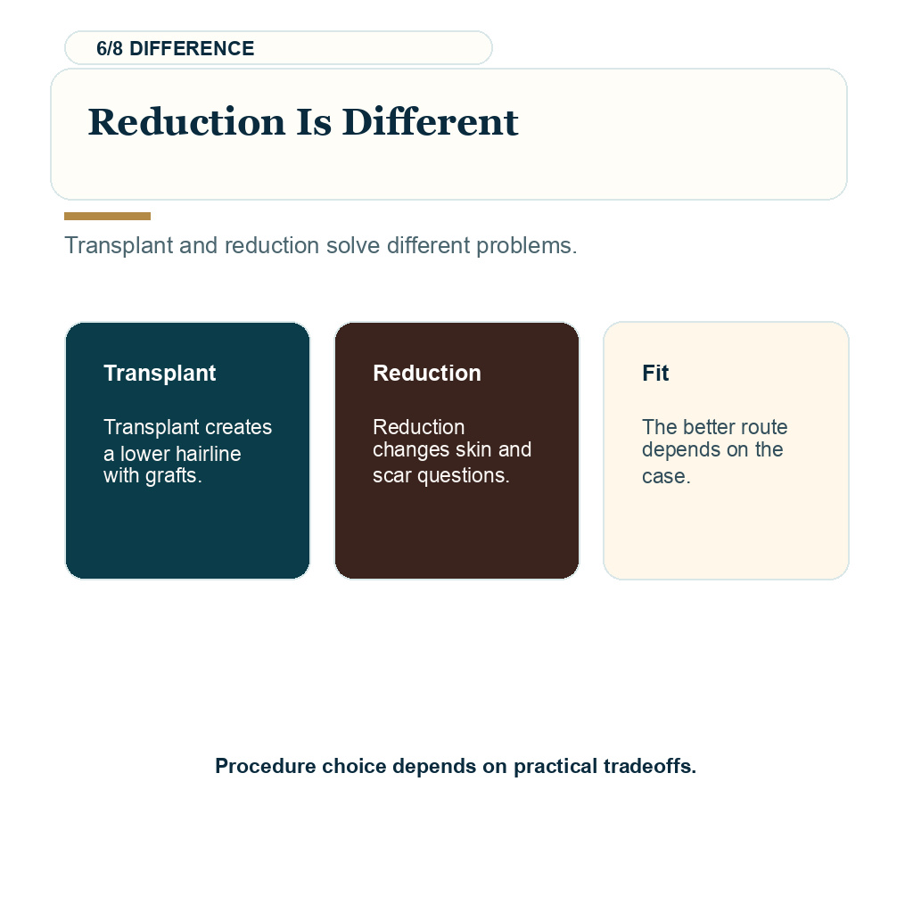 High forehead hair transplant showing reduction is different guidance.