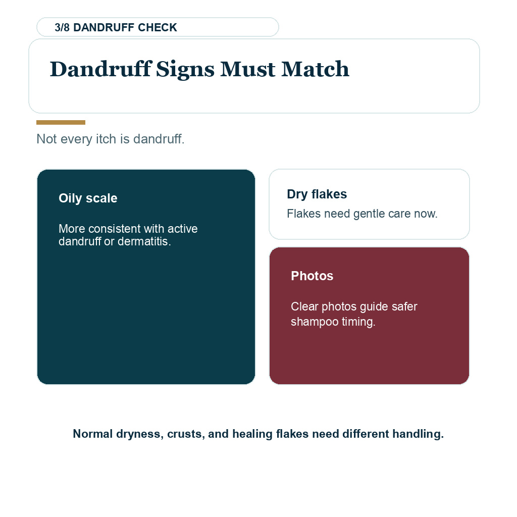 Carousel slide about dandruff signs must match when considering ketoconazole shampoo after a hair transplant.