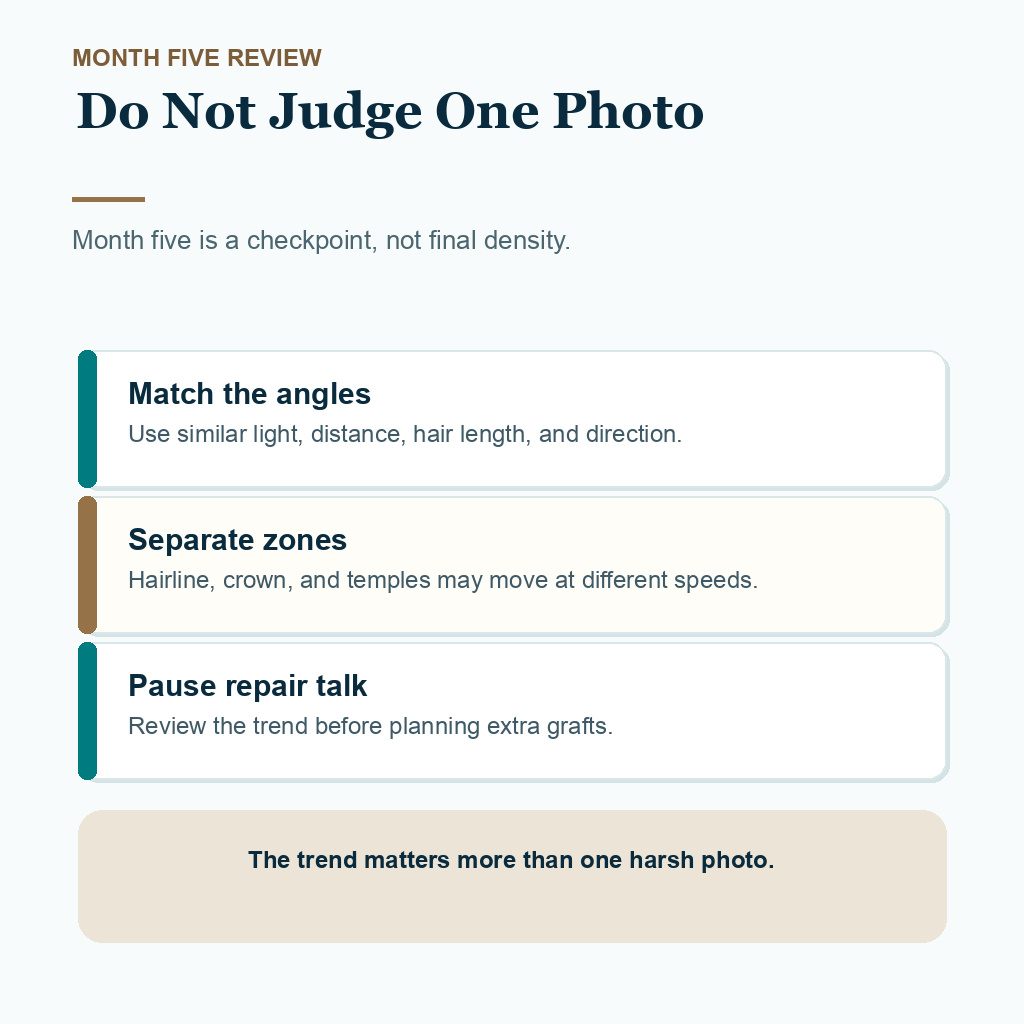 Diamond Hair Clinic support card showing photo review checks at month five after hair transplant
