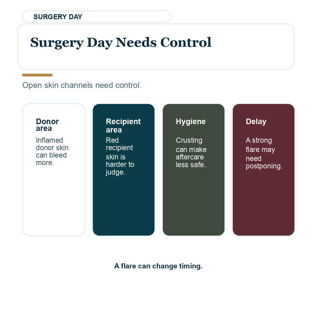 Hair transplant surgery day is safer when seborrheic dermatitis is controlled and the scalp surface is stable