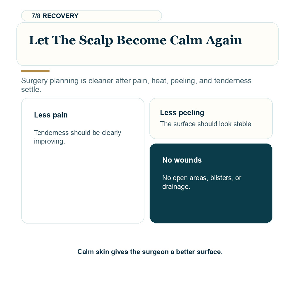 Sunburned scalp before hair transplant, let the scalp become calm again.