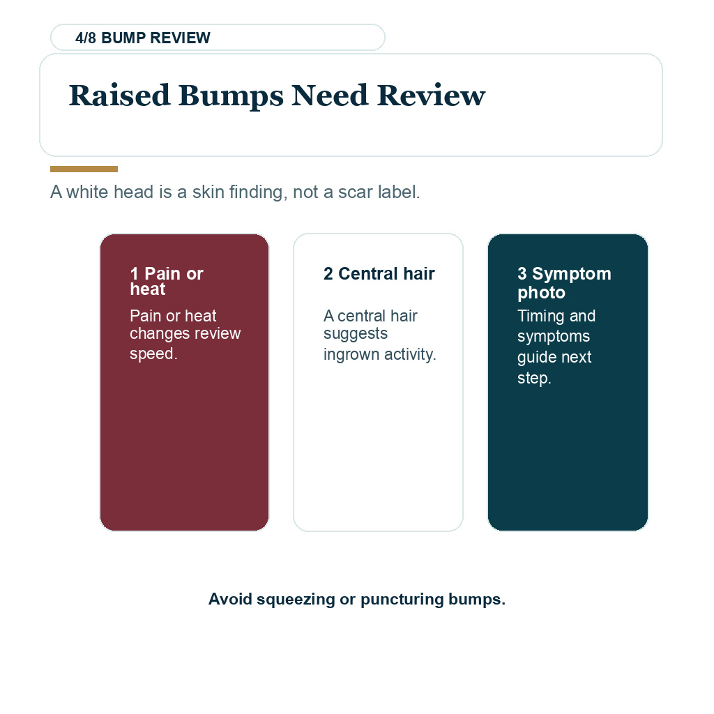 Diamond Hair Clinic white spots after FUE, raised bumps need review.