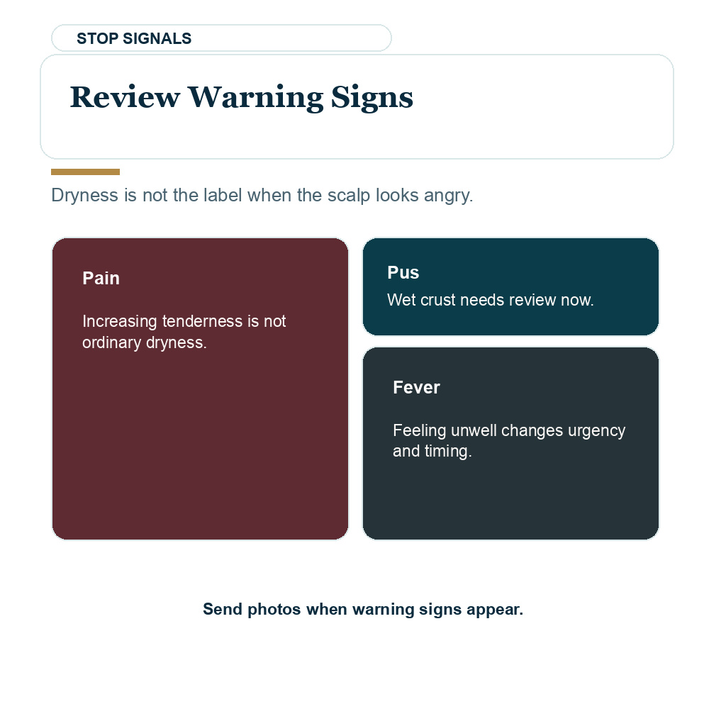 Dry scalp after hair transplant carousel image about review Warning Signs