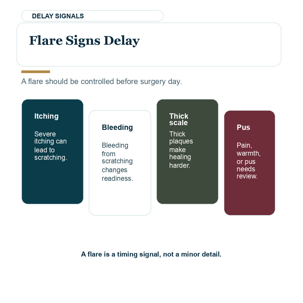 Active flare signs can delay hair transplant surgery until the scalp is controlled.