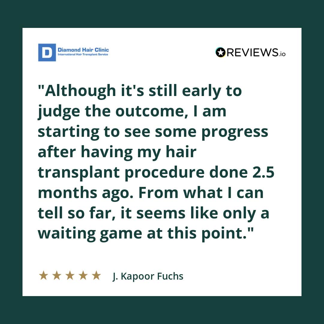Although it's still early to judge the outcome, I am starting to see some progress after having my hair transplant procedure done 2.5 months ago. From what I can tell so far, it seems like only a waiting game at this point.