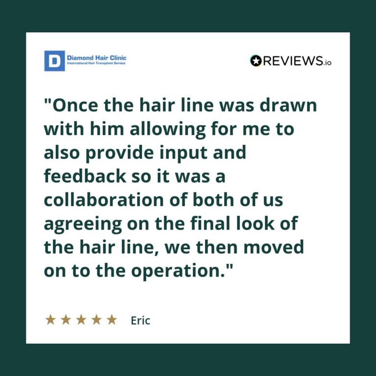 Patient review: Once the hair line was drawn with him allowing for me to also provide input and feedback so it was a collaboration of both of us agreeing on the final look of the hair line, we then moved on to the operation.