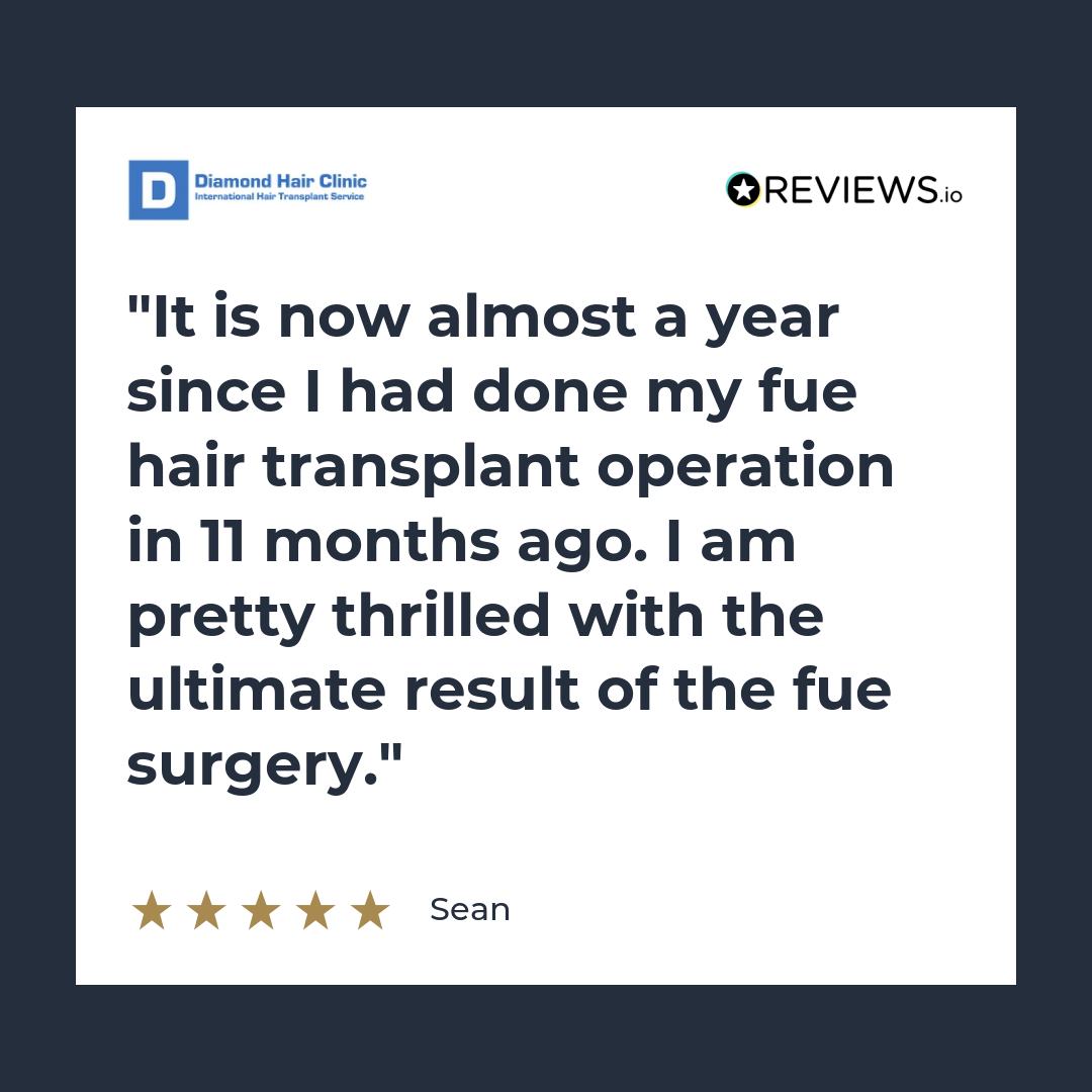 It is now almost a year since I had done my fue hair transplant operation in 11 months ago. I am pretty thrilled with the ultimate result of the fue surgery.