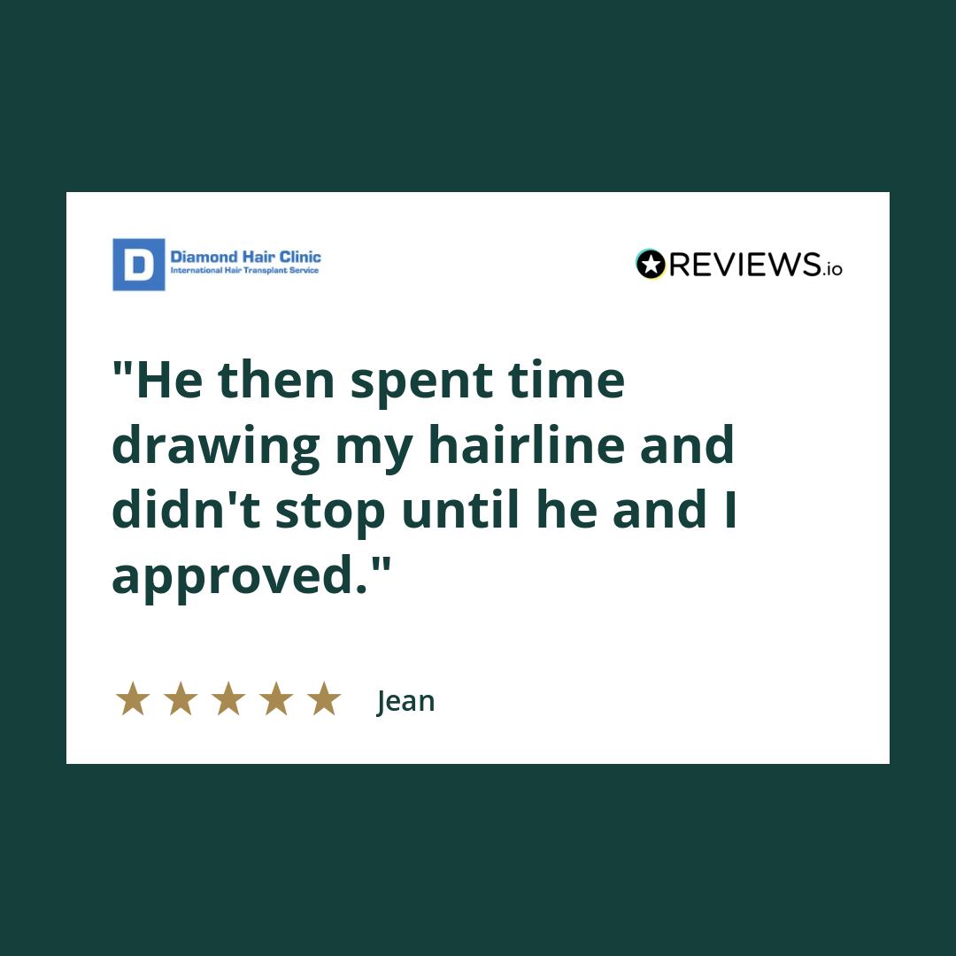 He then spent time drawing my hairline and didn't stop until he and I approved.