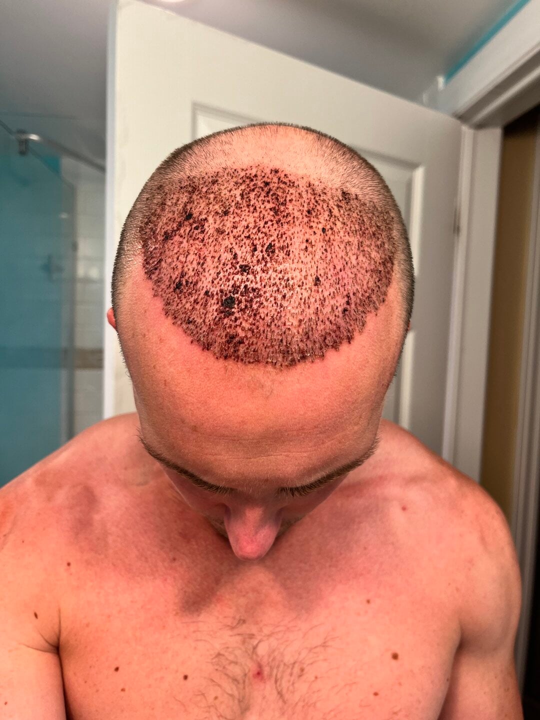 Tyler J. McInnes, recovery · front view