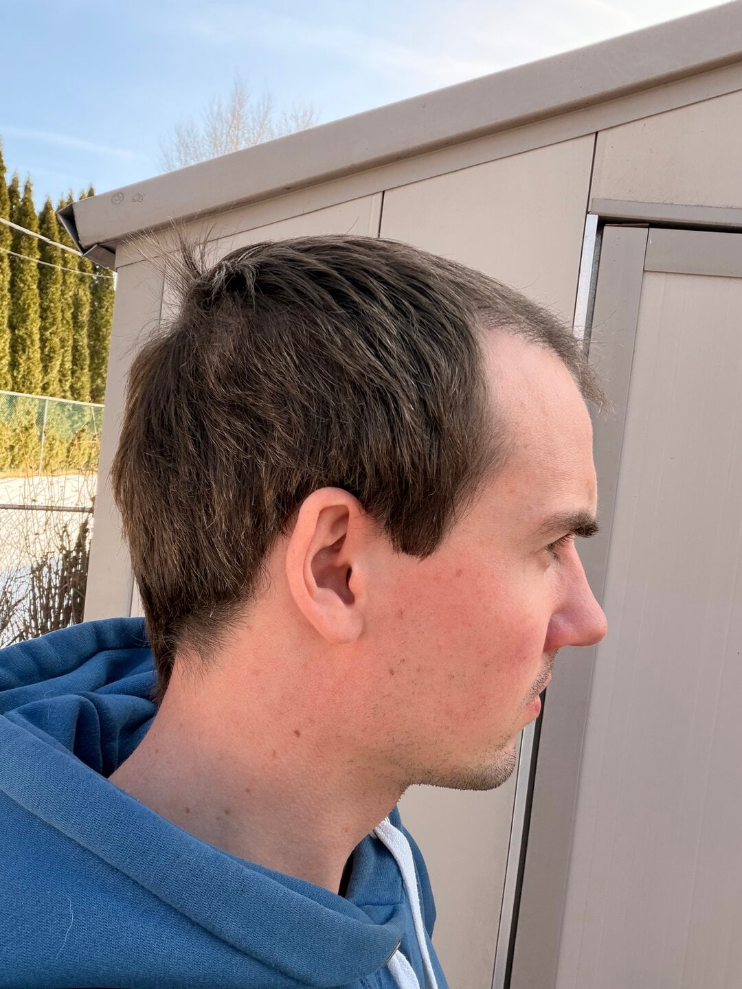 Tyler J. McInnes, later progress · side view